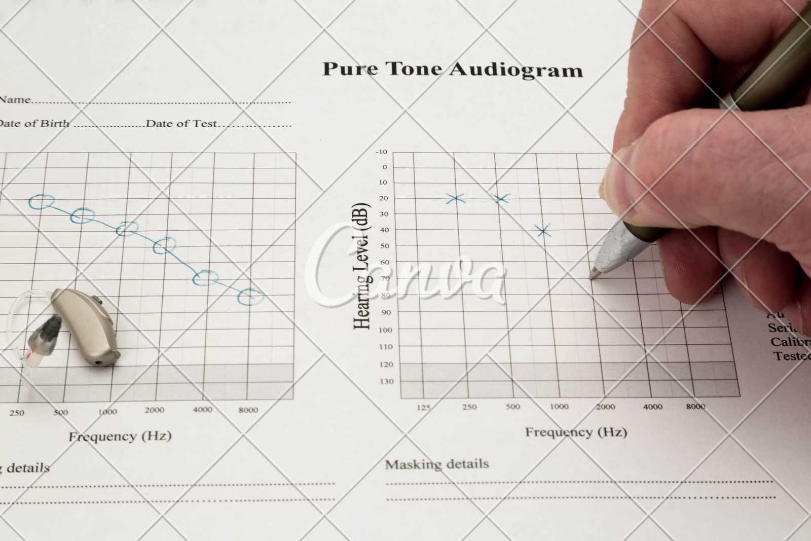 7328C26 Audiogram Template | Wiring Resources Within Blank Audiogram Template Download