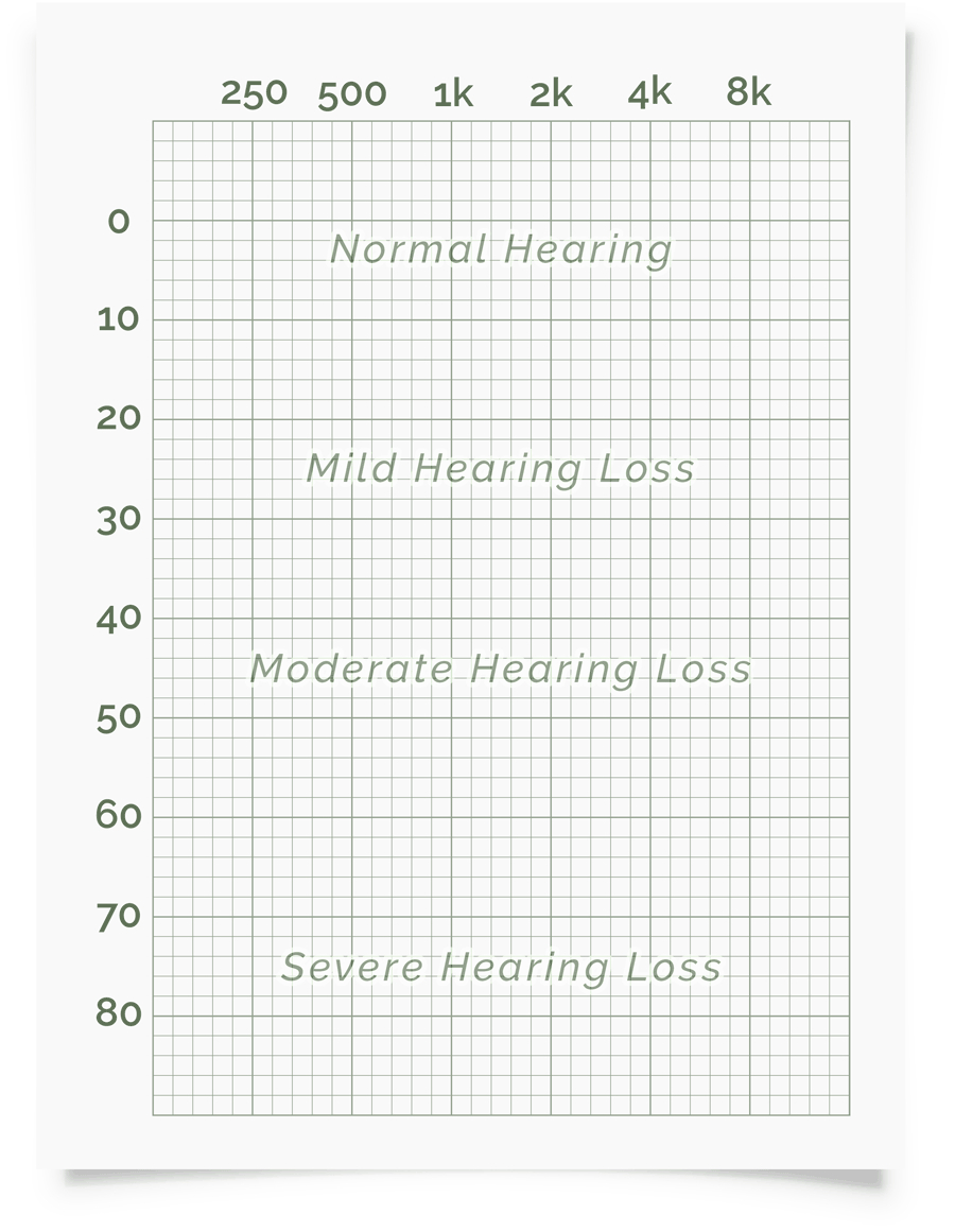 9B139 Audiogram Template | Wiring Library Intended For Blank Audiogram Template Download